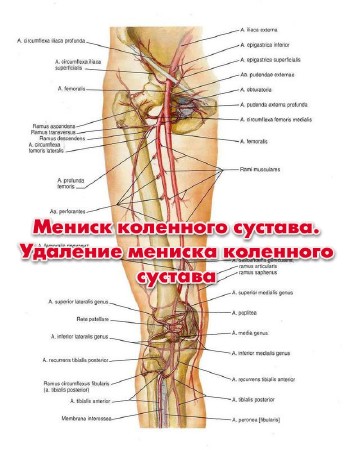 Мениск коленного сустава. Удаление мениска коленного сустава (2013)