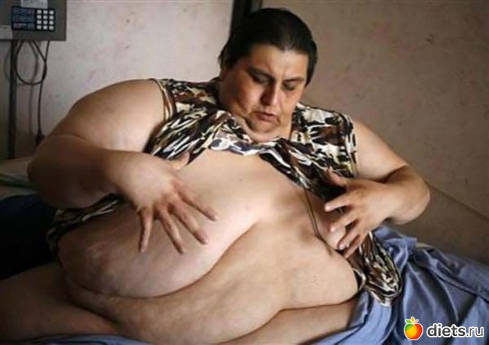 самые большие троло в мире у человека Всё о самых толстых - Самые толстые люди в мире