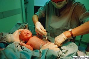 Главврач РДКБ отмечает тенденцию к снижению младенческой смертности