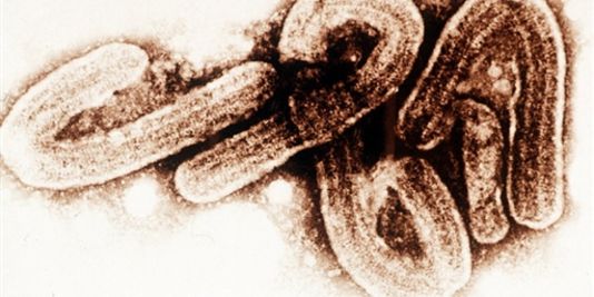 Das Ebola-virus unter dem mikroskop.